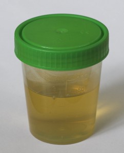Calendrier des examens du 1er trimestre de grossesse : l'analyse des urines