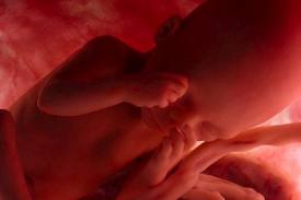 la vue du bébé 27 semaine - foetus