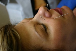 Préparation à l'accouchement avec acupuncture